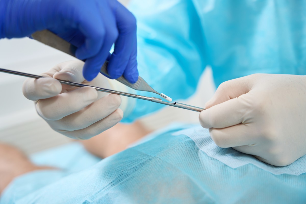 Surgeon in blue scrubs performing a procedure for hormone replacement