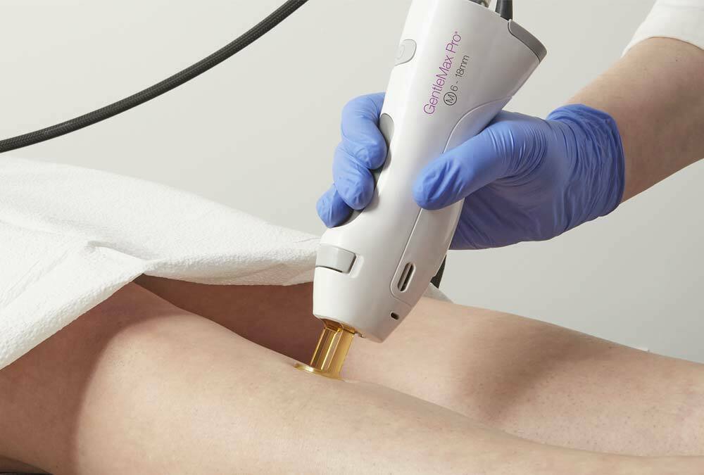 A healthcare professional at a health and medspa using a handheld laser device for skin treatment on a patient's stomach area.